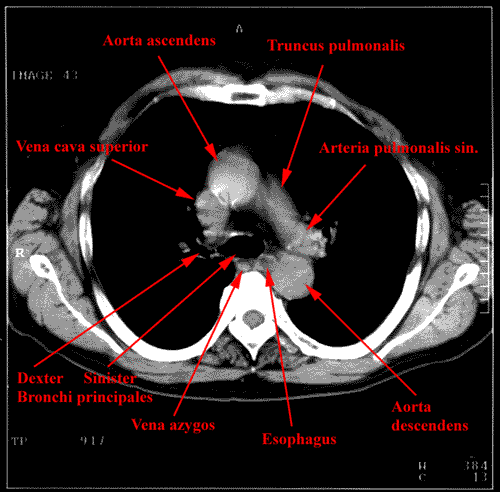 anatomia radiologiczna - 81.gif