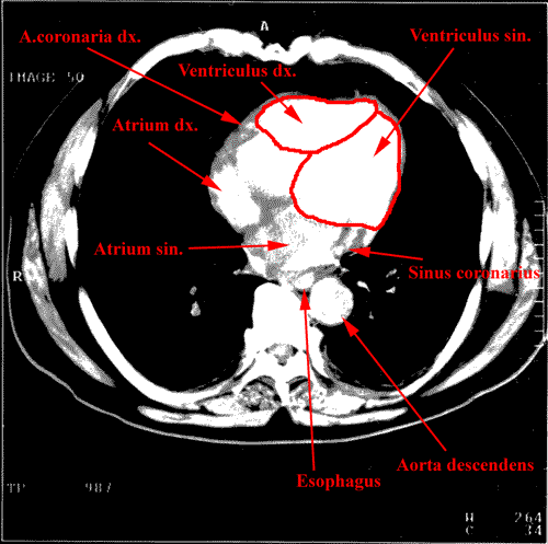 anatomia radiologiczna - 13.gif