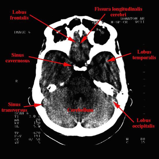 anatomia radiologiczna - 05b.jpg